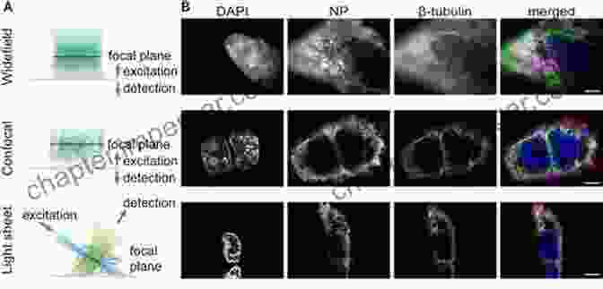 Comparison Of Fluorescence Microscopy Techniques Fundamentals Of Fluorescence Microscopy: Exploring Life With Light