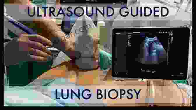 Surgeon Performing A Pleural Biopsy Key Questions In Thoracic Surgery