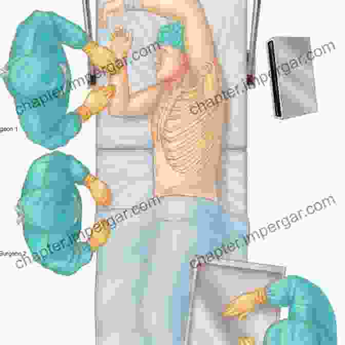 Thoracic Surgeon Operating On A Mediastinal Tumor Key Questions In Thoracic Surgery