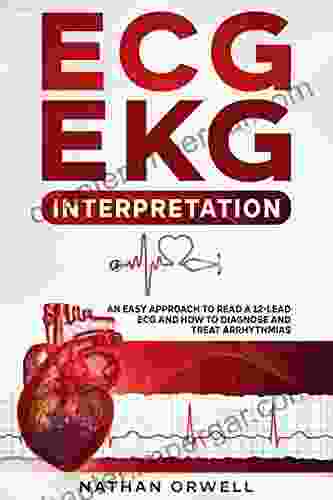 ECG/EKG Interpretation: An Easy Approach To Read A 12 Lead ECG And How To Diagnose And Treat Arrhythmias