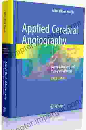 Cerebral Angiography: Normal Anatomy And Vascular Pathology