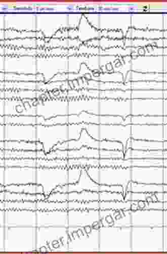 How To Read An EEG